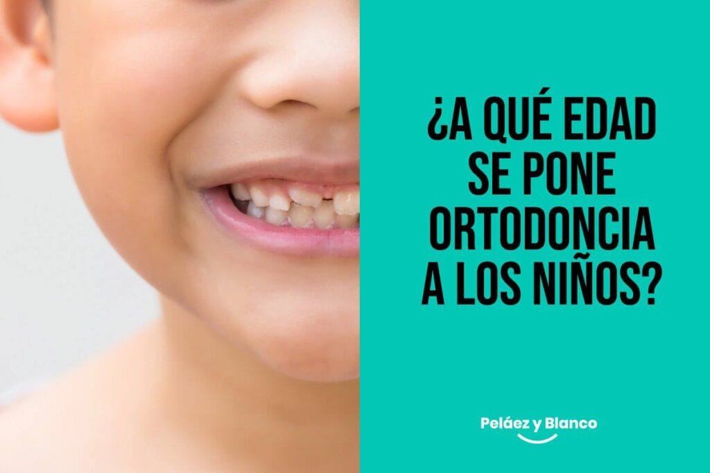 A qué edad se pone ortodoncia a los niños