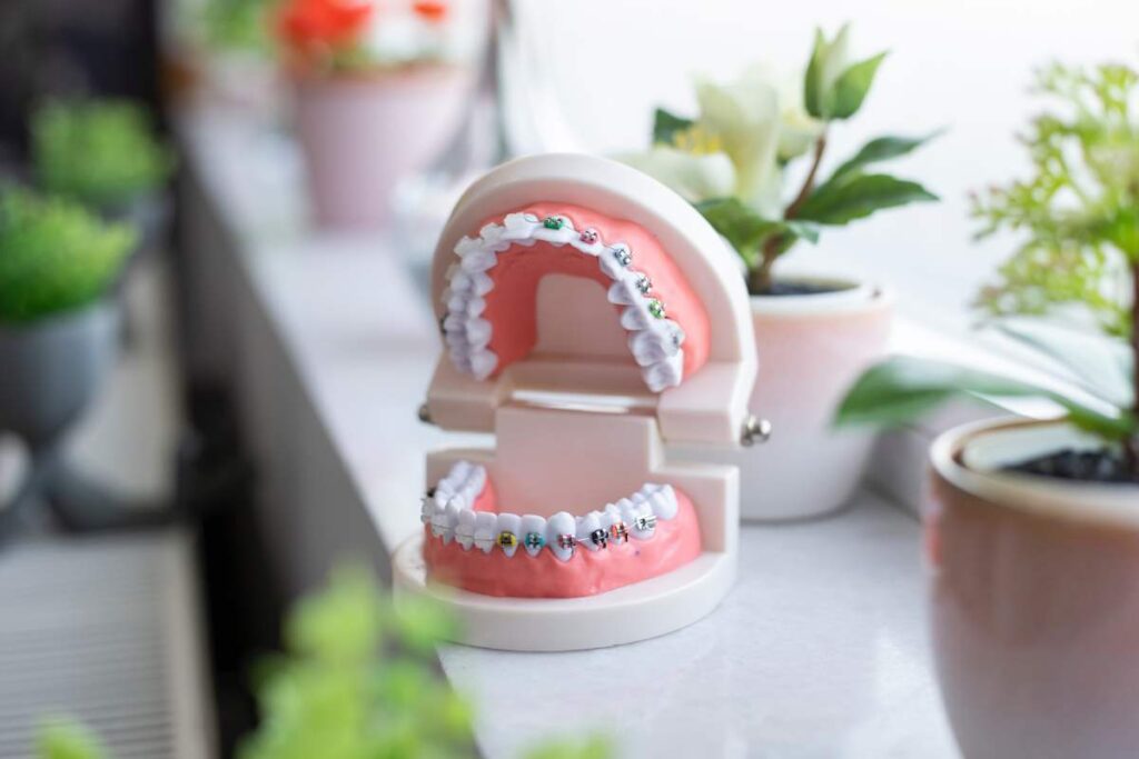 tipos de ortodoncia infantil