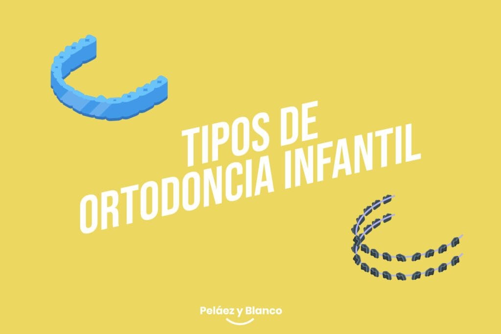 tipos de ortodoncia infantil