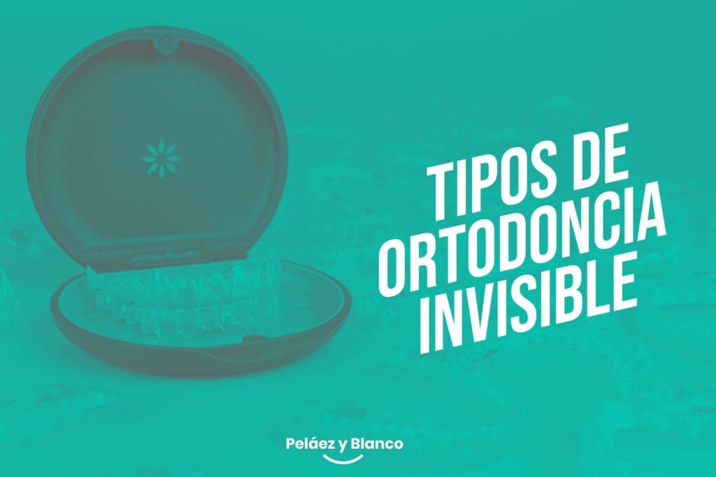 Tipos de ortodoncia invisible