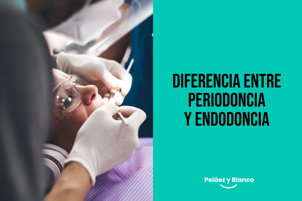 Diferencia entre periodoncia y endodoncia