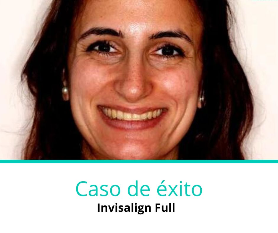 Caso de éxito invisalign full