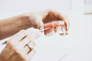 implantes dentales duele