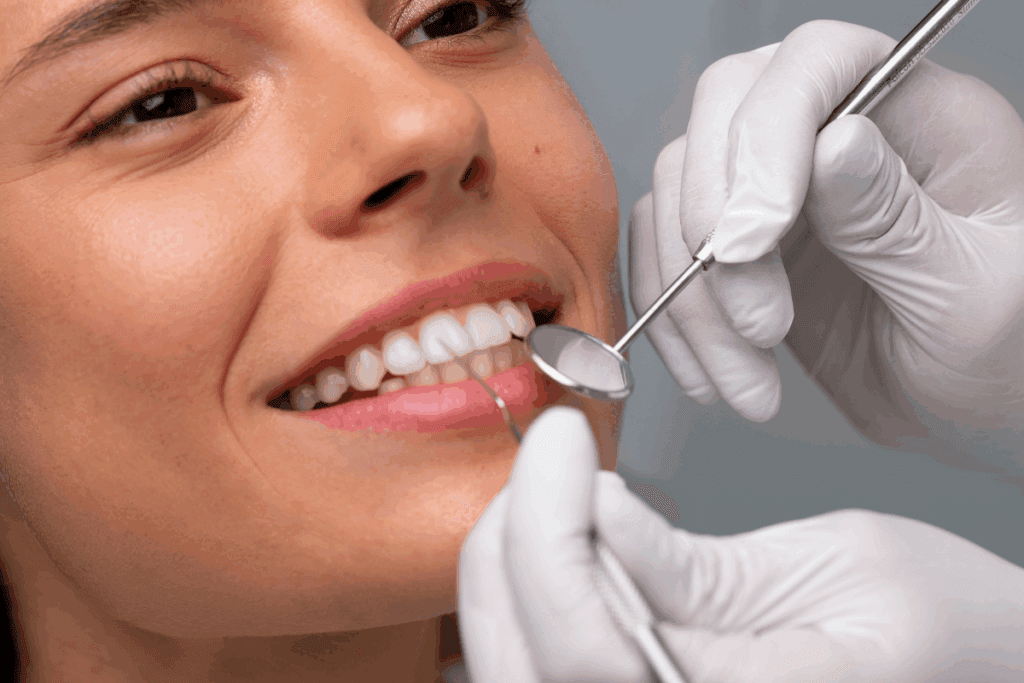 ¿Las carillas estropean los dientes?